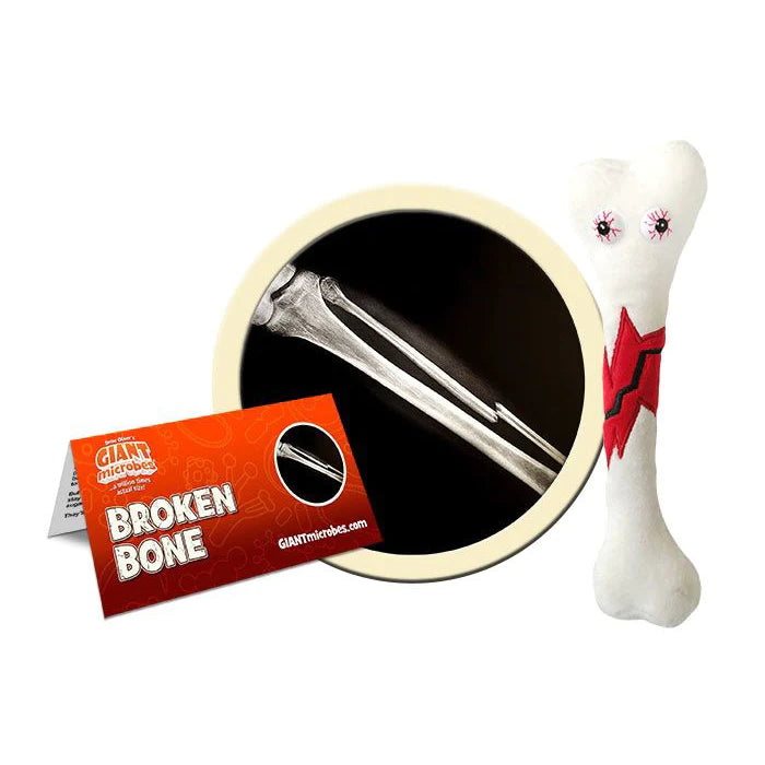 Broken Bone Giant Microbe